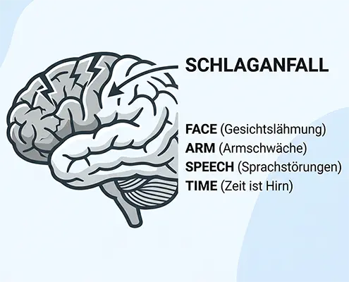Schlaganfall Symbolbild